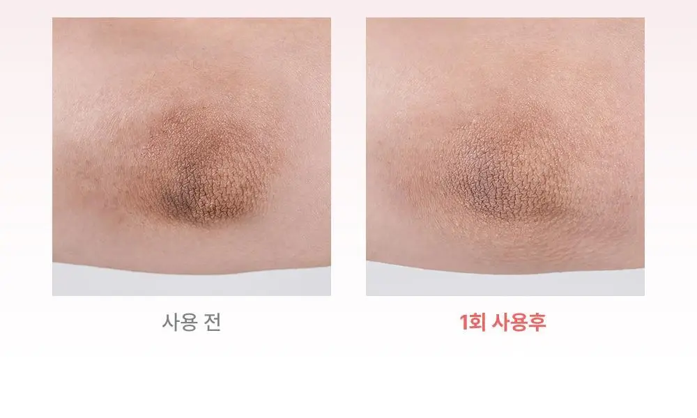 [꿈치케어/미백] 낫포유 브라이트닝 SOS 바디패드 10매입 상세페이지 2